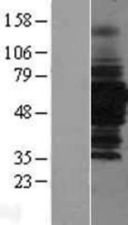 Novus Biologicals&trade;&nbsp;HDAC1 Overexpression Lysate