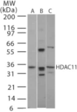 HDAC11 Antibody, Novus Biologicals:Antibodies:Primary Antibodies