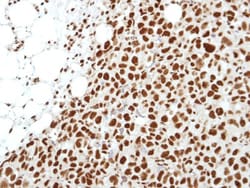 Histone Deacetylase 2/HDAC2 Antibody, Novus Biologicals 0.1mL; Unlabeled:Antibodies,