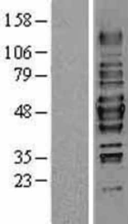 Novus Biologicals&trade;&nbsp;HDAC3 Overexpression Lysate