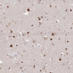 HDAC3 Antibody, Novus Biologicals 0.1mL; Unlabeled:Antibodies, Polyclonal