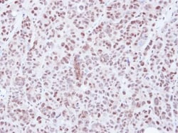 HDAC3 Antibody, Novus Biologicals 0.1mg; Unlabeled:Antibodies, Polyclonal