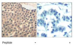 HDAC4+5+9 Antibody, Novus Biologicals 0.025 mL; Unconjugated:Antibodies,
