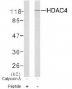 Histone Deacetylase 4/HDAC4 Antibody, Novus Biologicals:Antibodies:Primary