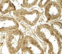HDAC6 Antibody - BSA Free, Novus Biologicals 0.1mg; Unlabeled:Antibodies,