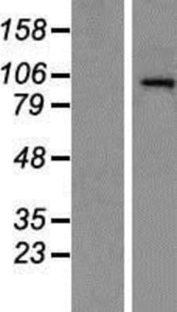 Novus Biologicals&trade;&nbsp;HDAC7 Overexpression Lysate