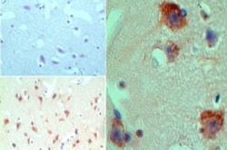 HDAC9 Antibody - BSA Free, Novus Biologicals 0.1mg; Unlabeled:Antibodies,