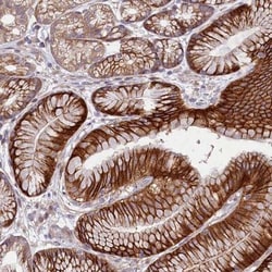 HDC Antibody, Novus Biologicals:Antibodies:Primary Antibodies