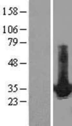 Novus Biologicals&trade;&nbsp;HDGF Overexpression Lysate