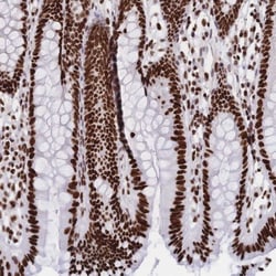 HDGF Antibody, Novus Biologicals 0.1mL; Unlabeled:Antibodies, Polyclonal