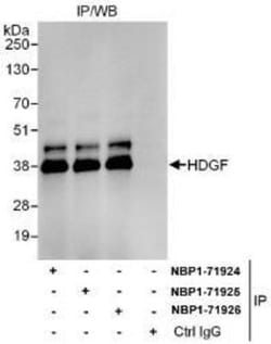 HDGF Antibody, Novus Biologicals 0.1mg; Unlabeled:Antibodies, Polyclonal