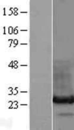Novus Biologicals&trade;&nbsp;HDGFRP3 Overexpression Lysate