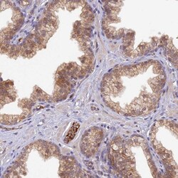 HDHD2 Antibody, Novus Biologicals 0.1mL; Unlabeled:Antibodies, Polyclonal
