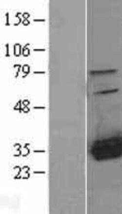 Novus Biologicals&trade;&nbsp;HDHD2 Overexpression Lysate