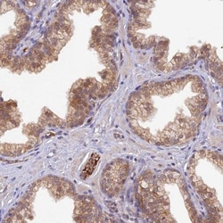 HDHD2 Antibody, Novus Biologicals 0.1mL; Unlabeled:Antibodies, Polyclonal
