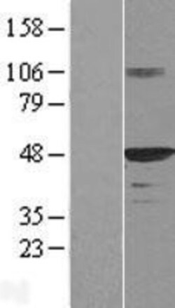 Novus Biologicals&trade;&nbsp;HDJ2 Overexpression Lysate