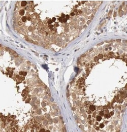 HDJ2 Antibody, Novus Biologicals 0.1mL; Unlabeled:Antibodies, Polyclonal