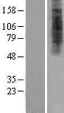 Novus Biologicals&trade;&nbsp;HDX Overexpression Lysate