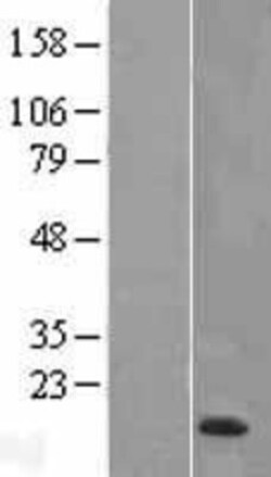 Novus Biologicals™ HE4/WFDC2 Overexpression Lysate