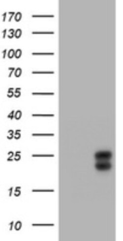 HE4/WFDC2 Antibody (OTI1E12), Novus Biologicals 0.1mL; Unlabeled:Antibodies,