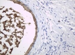 HE4/WFDC2 Antibody (OTI1E12), Novus Biologicals 0.1mL; Unlabeled:Antibodies,