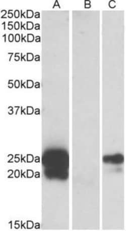 HE4/WFDC2 Antibody, Novus Biologicals 0.1mg; Unlabeled:Antibodies, Polyclonal