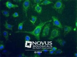 Novus Biologicals™ Hearing Loss Markers Antibody Pack