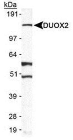 Novus Biologicals Hearing Loss Markers Antibody Pack 2 vials:Antibodies