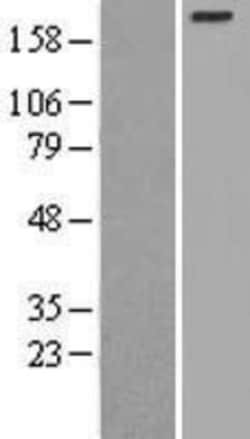 Novus Biologicals&trade;&nbsp;Myosin Heavy Chain 3 Overexpression Lysate