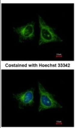 HEBP1 Antibody, Novus Biologicals 0.1mL; Unlabeled:Antibodies, Polyclonal