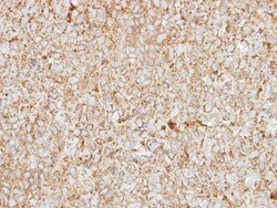 HEBP1 Antibody, Novus Biologicals 0.1mL; Unlabeled:Antibodies, Polyclonal
