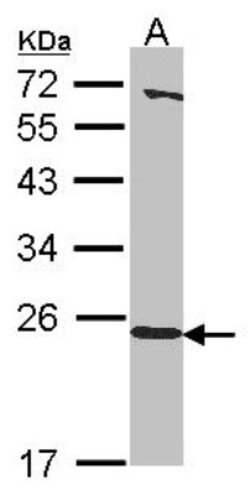 HEBP1 Antibody, Novus Biologicals 0.1mL; Unlabeled:Antibodies, Polyclonal
