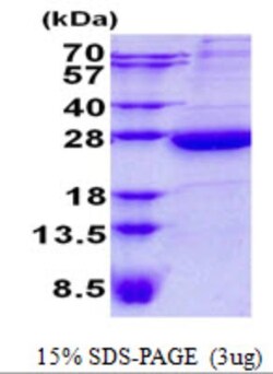 Novus Biologicals&trade;&nbsp;Recombinant Human HEBP1 His Protein