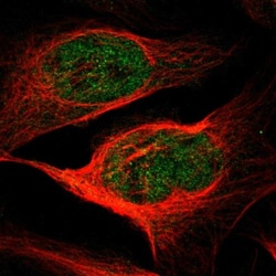 HEBP2 Antibody, Novus Biologicals 0.1mL; Unlabeled:Antibodies, Polyclonal