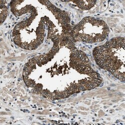HEBP2 Antibody, Novus Biologicals 0.1mL; Unlabeled:Antibodies, Polyclonal