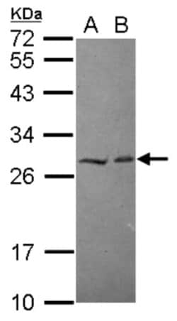 HECTD2 Antibody, Novus Biologicals 0.1mL; Unlabeled:Antibodies, Polyclonal