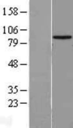 Novus Biologicals™ HECTD2 Overexpression Lysate