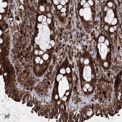 HECTD2 Antibody, Novus Biologicals:Antibodies:Primary Antibodies
