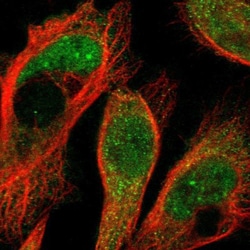 HECW1 Antibody, Novus Biologicals 25 &mu;L | Buy Online | Novus Biologicals | Fisher Scientific