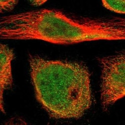 HECW1 Antibody, Novus Biologicals:Antibodies:Primary Antibodies
