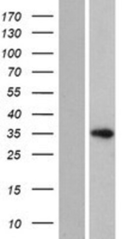 Novus Biologicals&trade;&nbsp;HELT Overexpression Lysate