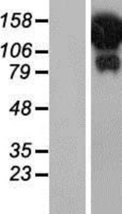 Novus Biologicals™ HELZ Overexpression Lysate