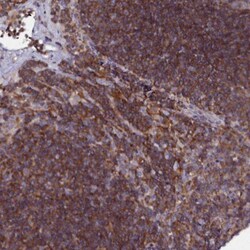 HEM1 Antibody, Novus Biologicals:Antibodies:Primary Antibodies