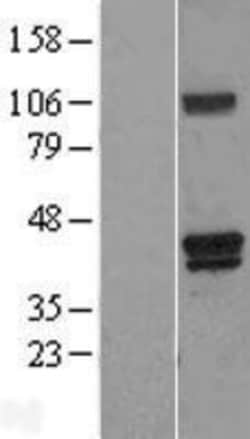 Novus Biologicals™ HO-2/HMOX2 Overexpression Lysate
