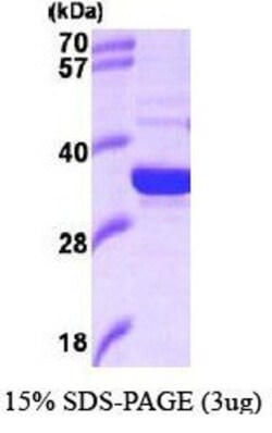 Novus Biologicals Recombinant Human HO-2/HMOX2 Protein 0.1 mg | Buy Online | Novus Biologicals&trade; | Fisher Scientific