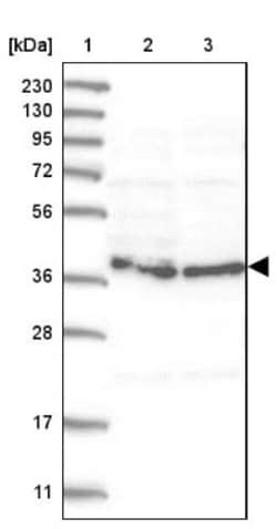 HEMK1 Antibody, Novus Biologicals:Antibodies:Primary Antibodies