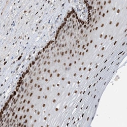 HEMK1 Antibody, Novus Biologicals:Antibodies:Primary Antibodies