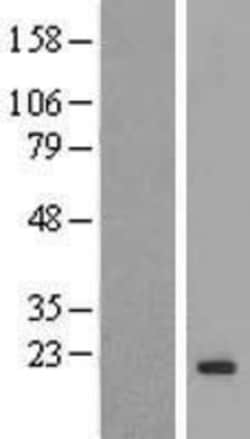 Novus Biologicals&trade;&nbsp;HEMK2 Overexpression Lysate