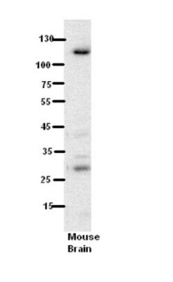 HEMK2 Antibody, Novus Biologicals 20&mu;L; Unlabeled:Antibodies, Polyclonal