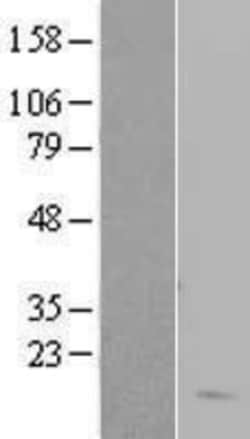 Novus Biologicals&trade;&nbsp;Hemoglobin delta Overexpression Lysate